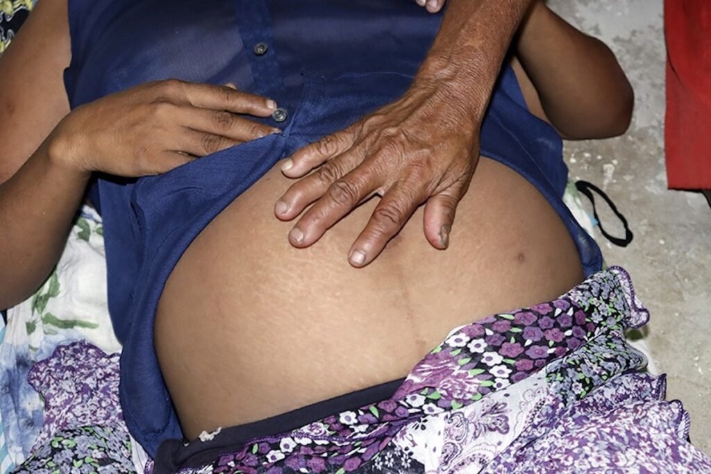 El pujar silencioso de una parturienta yukpa