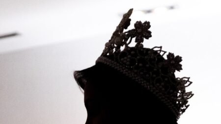 Exmiss venezolana se encuentra en grave situación médica y pide ayuda: “Es una operación delicada y costosa”